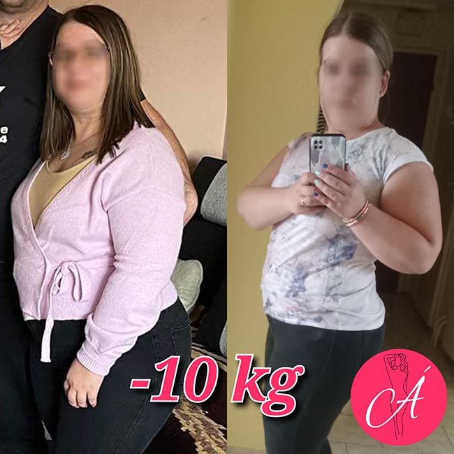 álomalak 10 kg fogyás előtte-utána kép