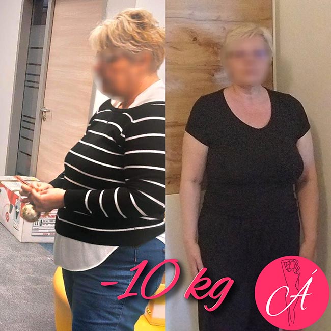 álomalak 10 kg fogyás előtte-utána kép