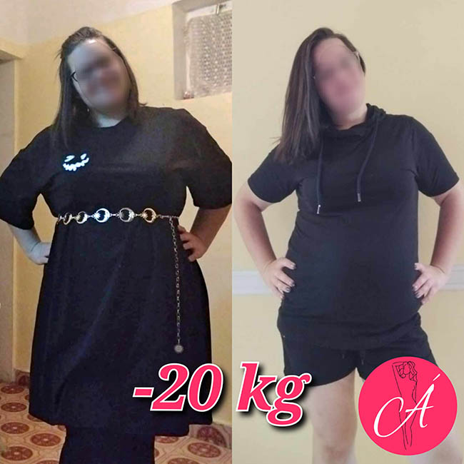 álomalak 20 kg fogyás előtte-utána kép